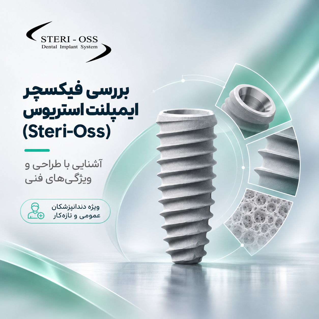 مراجعة غرسة ستيري أوس (Steri-Oss)؛ تعرّف على التصميم والخصائص التقنية